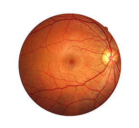 Mapeamento de retina.