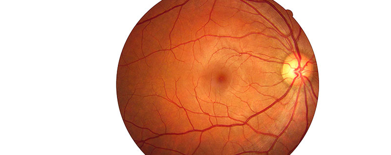 clinica-bolzan-oftalmologia-blog-mapeamento-de-retina